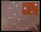 Enterococcus faecalis on blood agar